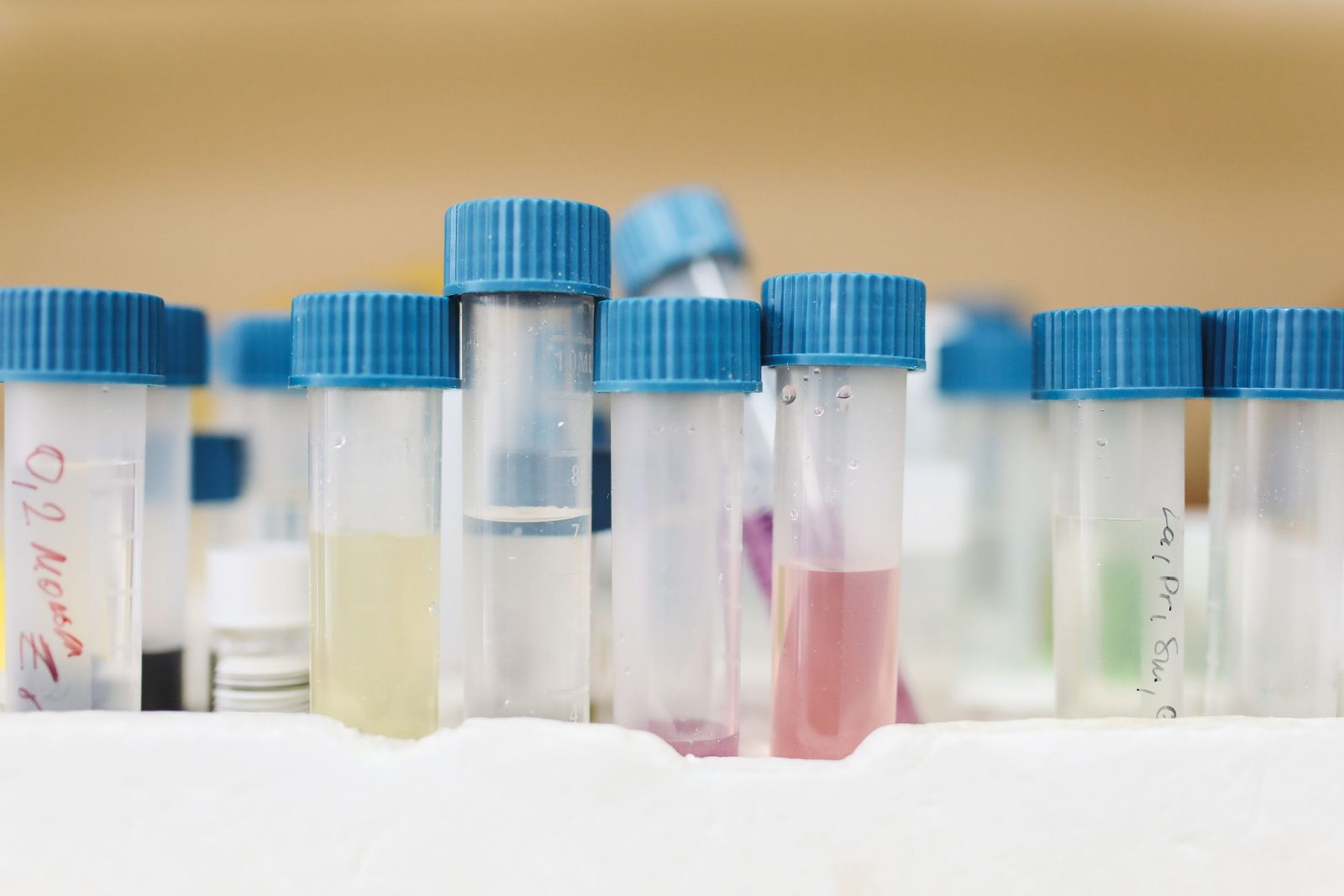 Rows of sample tubes with blue caps in a laboratory rack.